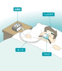 SAS（睡眠時無呼吸症候群）の治療について