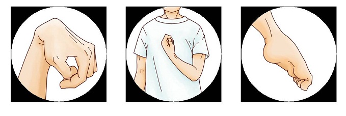 /hannan/upload/department/page/botulinum_therapy-1.jpg