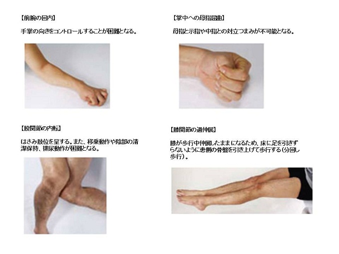 /hannan/upload/department/page/shisei-2_1.jpg