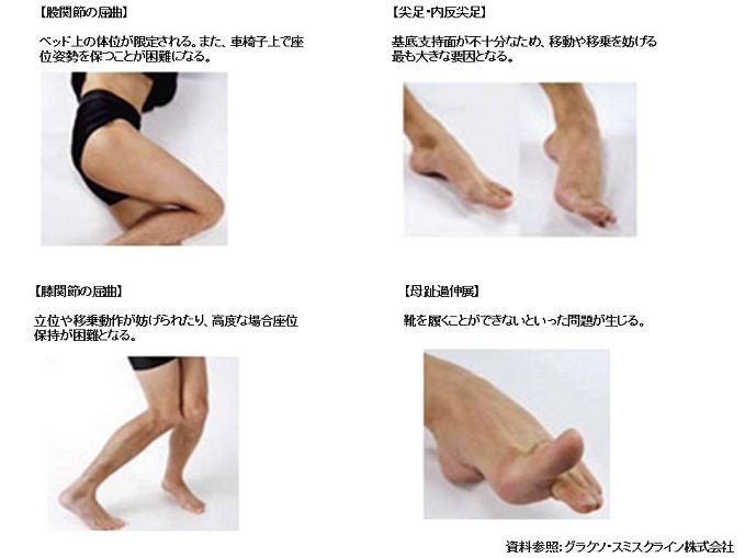 /hannan/upload/department/page/shisei-3_1.jpg