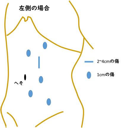 腎細胞がん 泌尿器科 診療科 部門紹介 ベルランド総合病院 社会医療法人 生長会