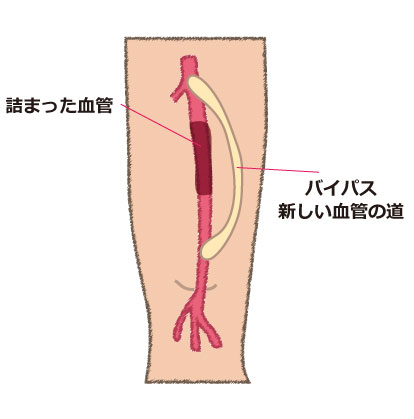 /bell/upload/department/page/bell-junai_blood_bypass.jpg