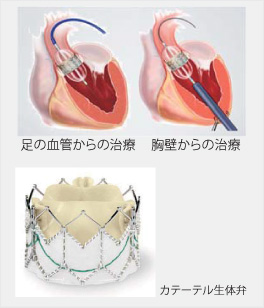 /bell/upload/department/page/bell_teishinshu_img2.jpg