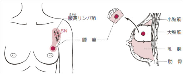 /bell/upload/department/page/mammary1.jpg