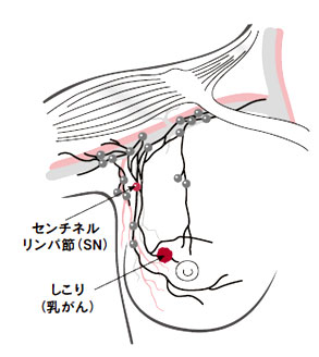 /bell/upload/department/page/mammary5.jpg
