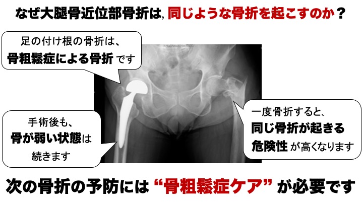 /bell/upload/department/page/orthopaedic_surgery4.jpg