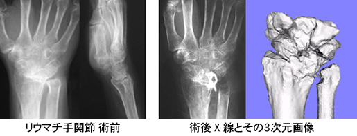 /bell/upload/department/page/rheumatism.jpg