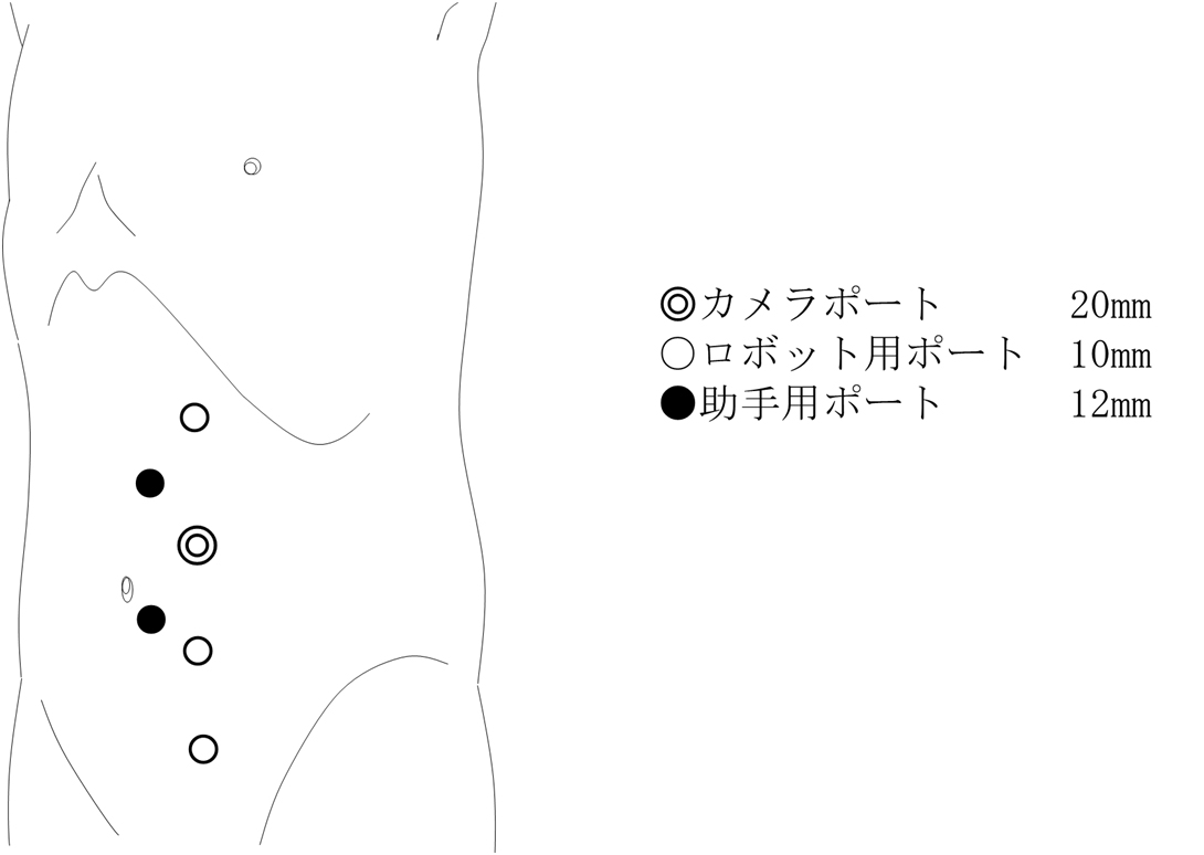 /bell/upload/department/page/robot_009.jpg