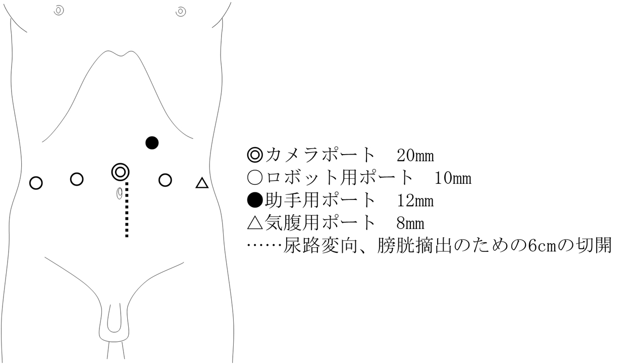 /bell/upload/department/page/robot_016.jpg