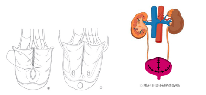 /bell/upload/department/page/urology_5.png