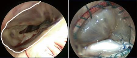 /ozumc/upload/department/page/cardiovascular_surgery11.jpg