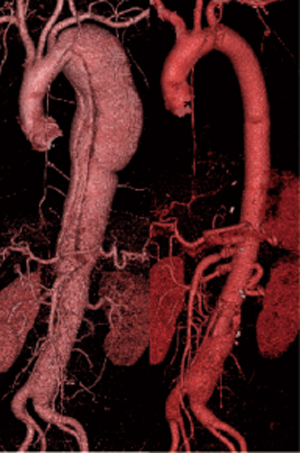 /ozumc/upload/department/page/cardiovascular_surgery14.jpg