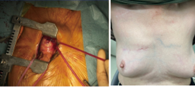 /ozumc/upload/department/page/cardiovascular_surgery3.jpg