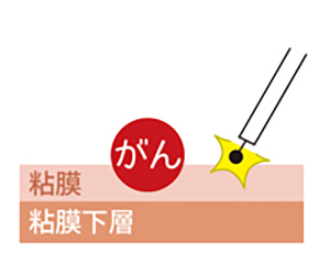 /ozumc/upload/department/page/gastroenterology_1.jpg