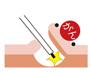 /ozumc/upload/department/page/gastroenterology_3.jpg