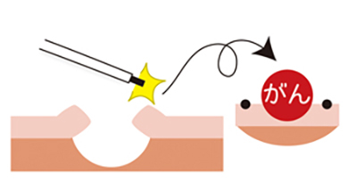 /ozumc/upload/department/page/gastroenterology_4.jpg