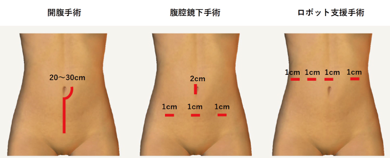 /ozumc/upload/department/page/gynecology1.jpg