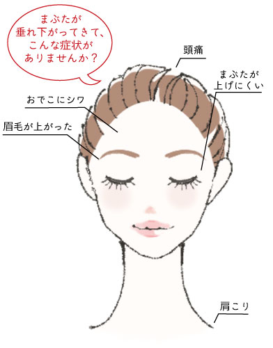 /ozumc/upload/department/page/keisei_ptosis1.jpg