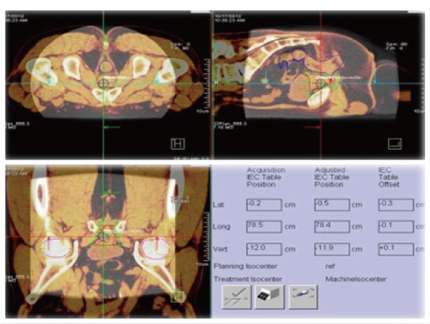 /ozumc/upload/department/page/linac9.jpg