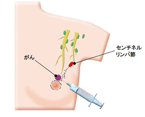 /ozumc/upload/department/page/mammary15.jpg