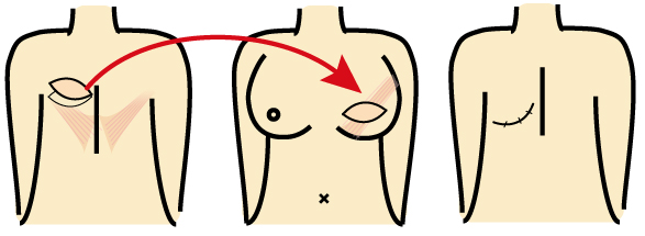 /ozumc/upload/department/page/mammary18_ld.jpg