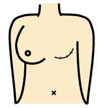 /ozumc/upload/department/page/mammary21.jpg