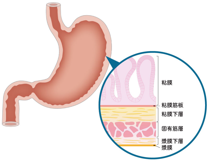 /ozumc/upload/department/page/stoma1.jpg